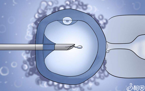 试管助孕包男女性别选择技术