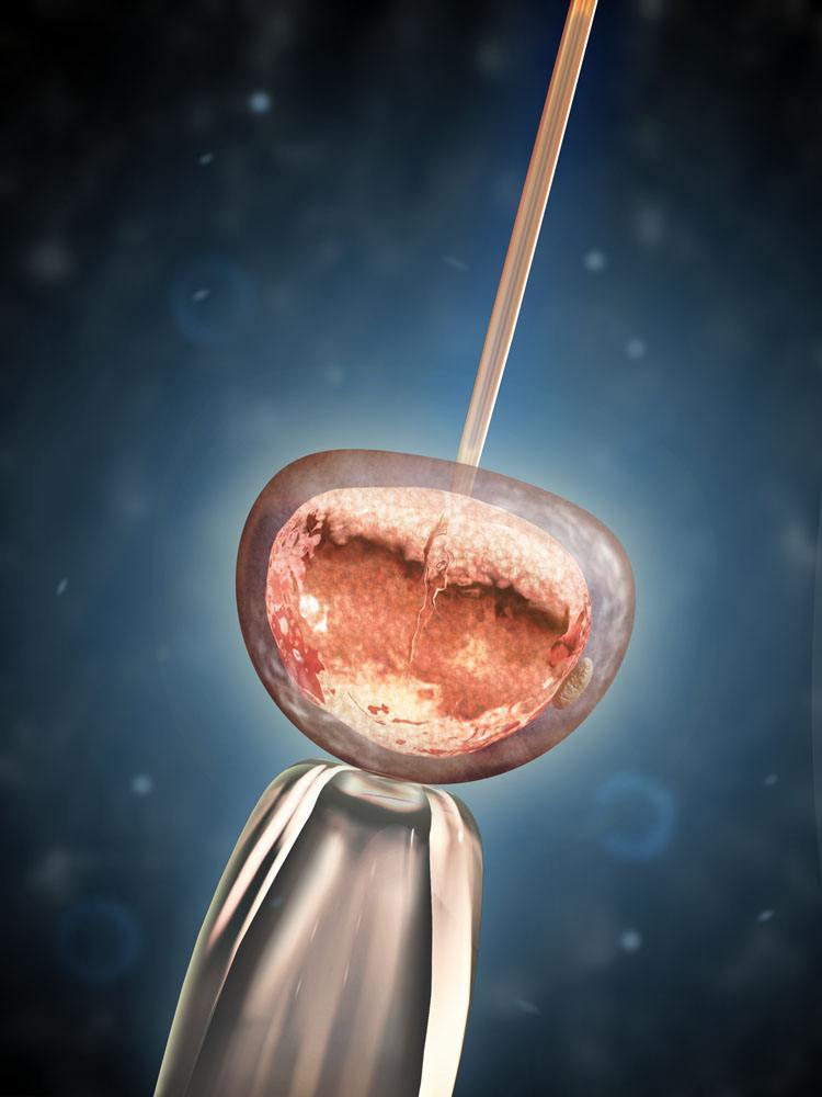 试管周期 胚胎移植成功率影响因素分析