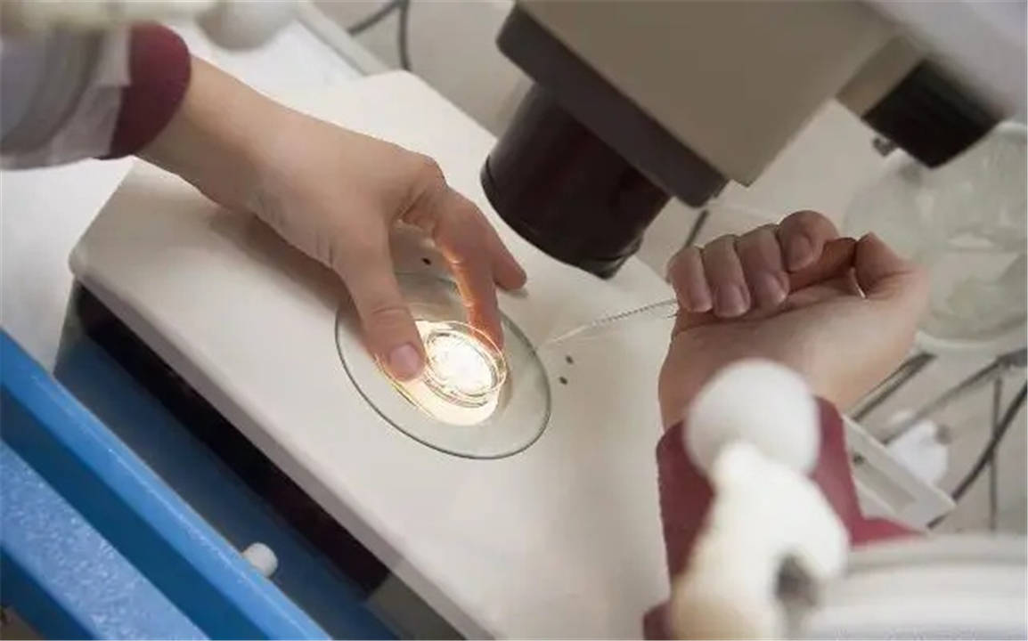 试管婴儿 完整流程时间轴